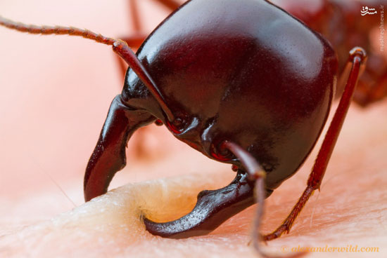 عکس: لحظه گاز گرفتن مورچه از انسان