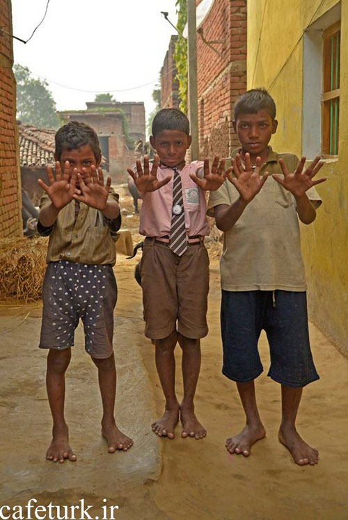 دهکده عجیب 6 انگشتی های هندوستان