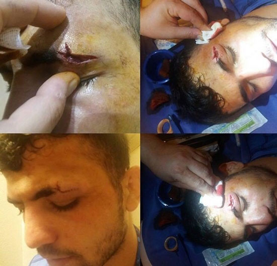 مصدومیت شدید قادریان