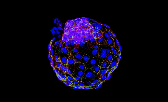 تولید اولین مدل کامل جنین انسان با سلول‌ پوست