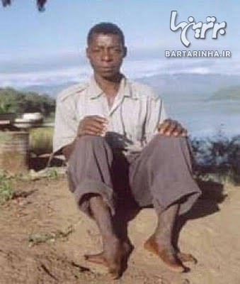 قبیله آفریقایی که پاهای عجیبی دارند +عکس