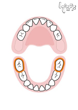ترتیب رشد دندان های کودک