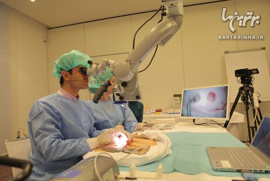 کشف تکنیک جدید جراحی میکروسکوپی ایمپلنت توسط دکتر بهنام شکیبایی