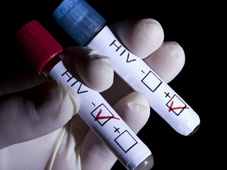 این آزمایش‌ها تکلیف ایدز را روشن می‌کنند