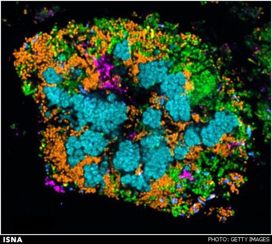 تصاویر رنگارنگ از میکروب‌های دندان