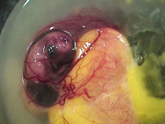 تصاویری جالب از مراحل رشد جنین مرغ