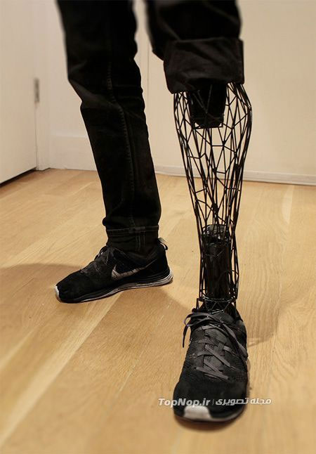 پروتز پای مصنوعی پرینت شده +عکس