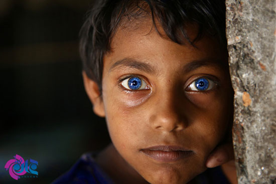 کودکی با چشمان حیرت آور +عکس