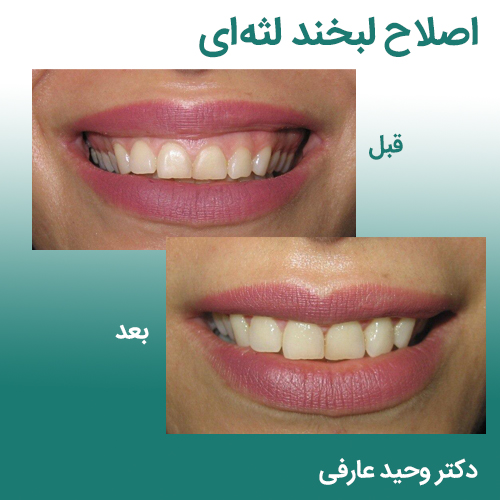 متخصص بیماری‌های لثه و دهان ـ دکتر وحید عارفی