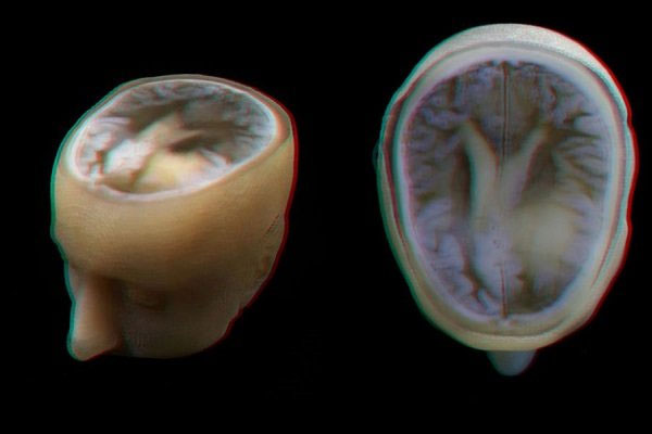 مدل سه بعدی دقیق مغز انسان تهیه شد