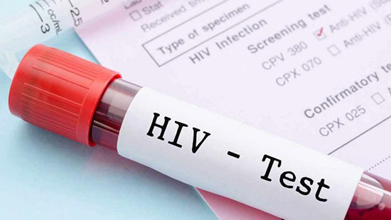 من یک HIV مثبت هستم