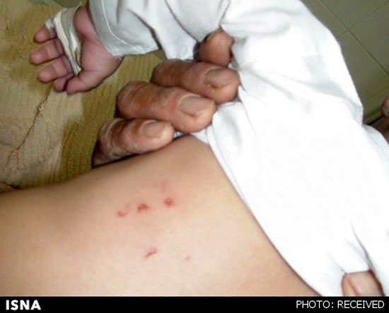 شکنجه نوزاد 6 ماهه در دخمه معتادان +عکس