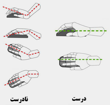 دردشناسی «دست»