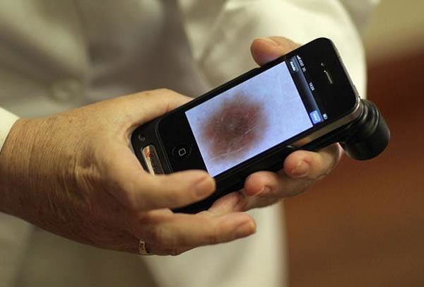 تشخیص سرطان پوست با هوش مصنوعی