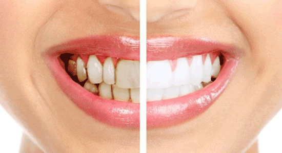 بهترین متخصص زیبایی دندان را چگونه انتخاب کنیم؟