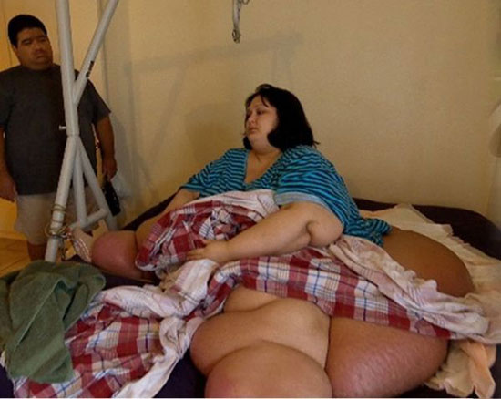سنگین‌ترین زن دنیا 300 کیلو لاغر کرد! +عکس