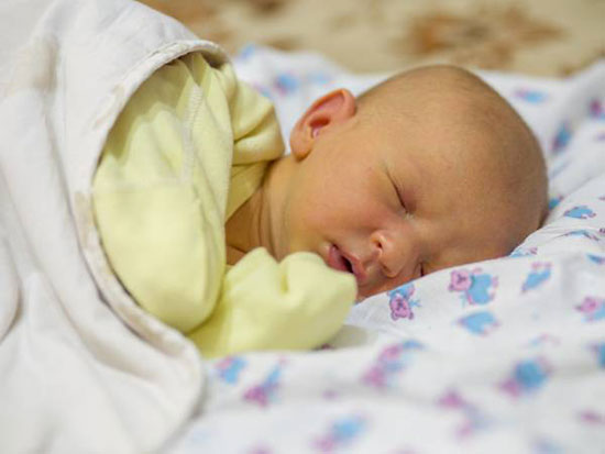 درمان‌های خانگی زردی نوزاد