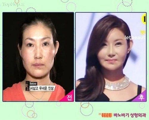 زیبارویان جراحی شده در کره جنوبی +عکس