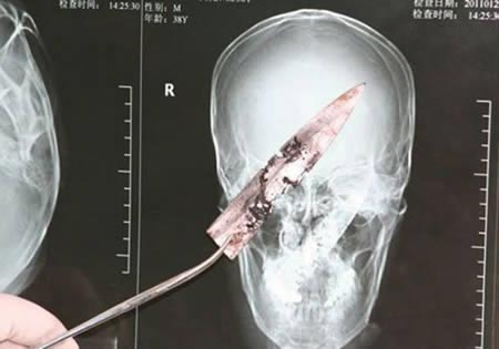 عجیب ترین عکس های رادیولوژی پزشکی