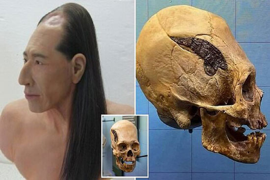 شواهدی از جراحی جمجمه در ۲هزار سال قبل!