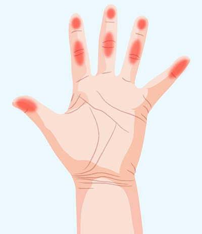 دست ها چه چیزهایی درباره سلامت ما می گویند؟