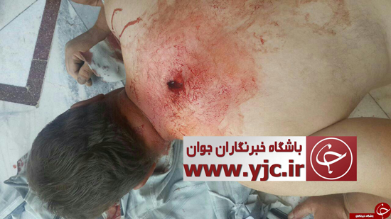 اولین تصاویر از مجروحین تیراندازی در حرم امام
