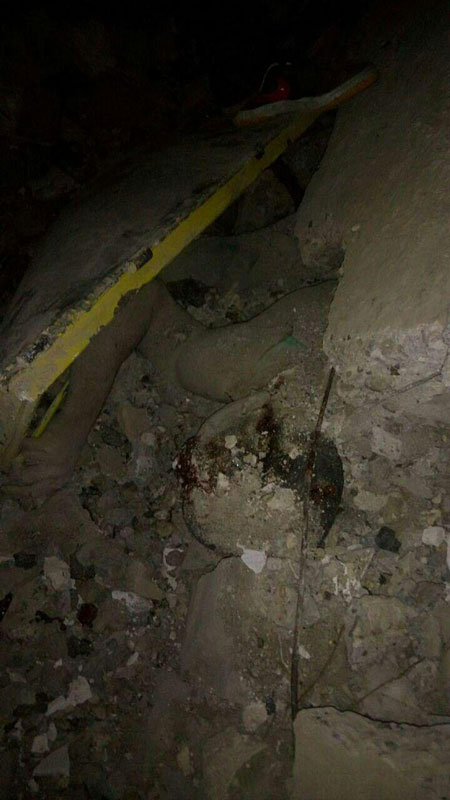 تصویر دردناکی از زلزله کرمانشاه (18+)