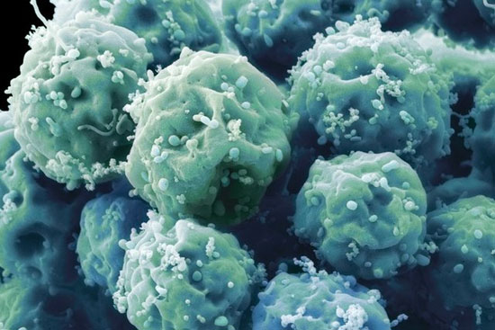 سلول‌های بنیادی ممکن است سرطان‌زا باشند