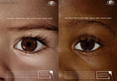 فیلم: سرطان چشم در کودکان را به راحتی تشخیص دهید
