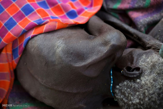 عکس: شیوع تب سیاه در آفریقا