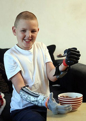 جوانترین فرد جهان با 2 دست مصنوعی