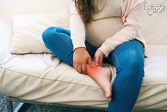 درمان خانگی تورم پا‌ها در دوران بارداری