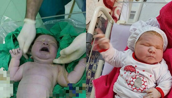 تولد نوزاد ۶کیلویی در اردکان