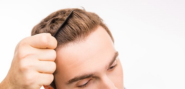 مزایا و معایب کاشت مو به روش fit چیست؟