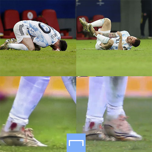 وقتی مسی با پای زخمی برای آرژانتین جنگید