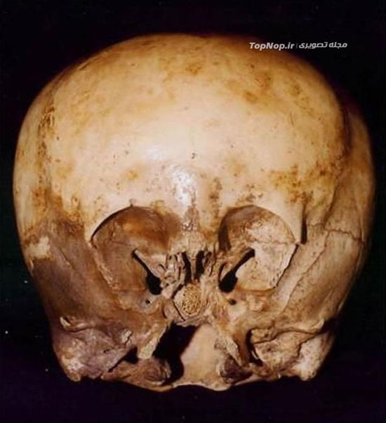 جمجمه 900 ساله تاریخی و مرموز +عکس