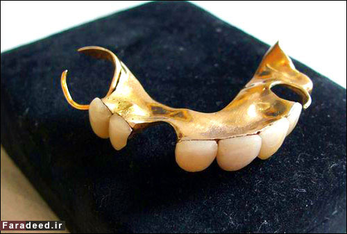 دندان‎های مصنوعی چرچیل