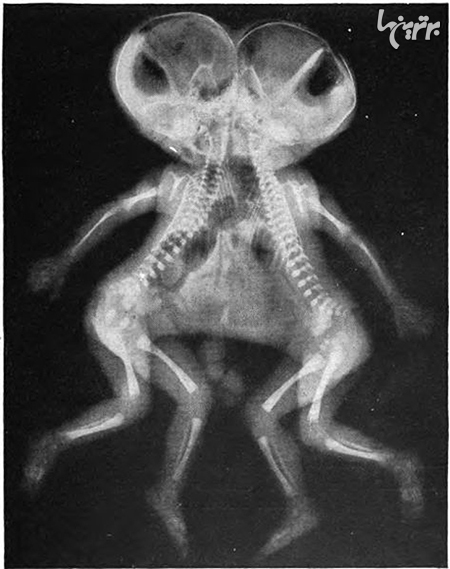 عکس‌های عجیب و غریب رادیولوژی