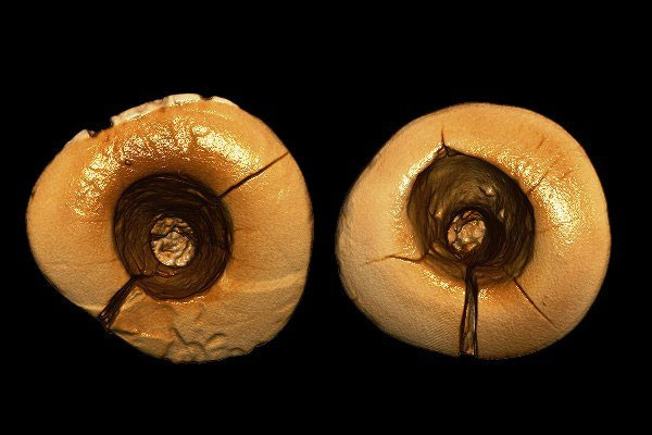 اولین دندان پر شده تاریخ کشف شد