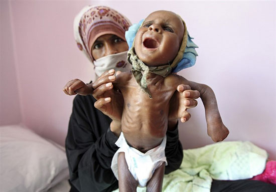 شهادت 1400 کودک یمنی توسط سعودی ها