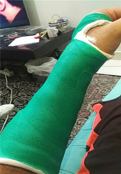 ملی پوش بسکتبال، دستش را گچ گرفت