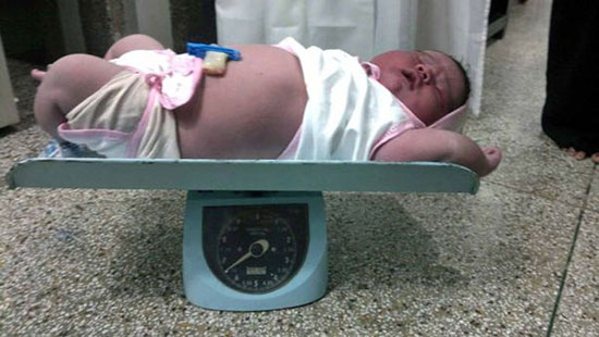 بزرگترین نوزاد تاریخ هند متولد شد +عکس