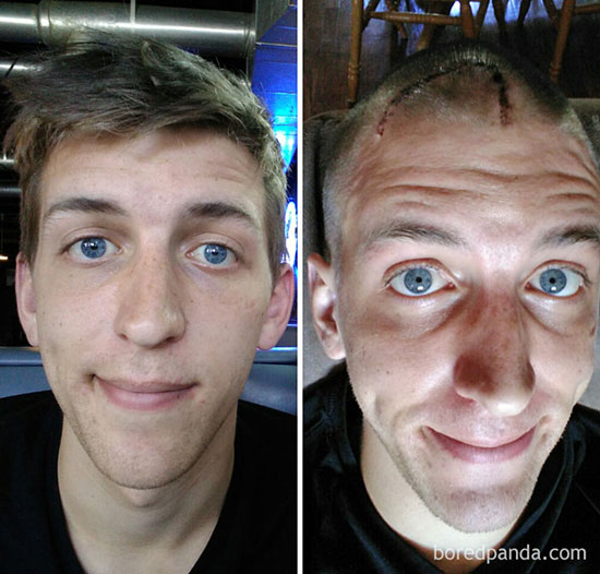 عکس‌های قبل و بعد کسانی که با سرطان مبارزه کردند