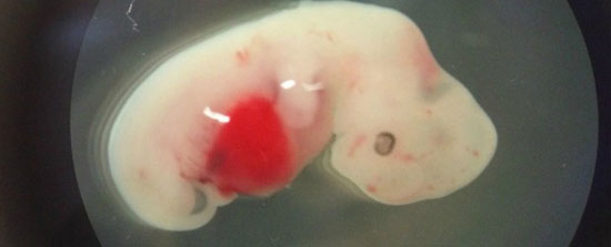 پرورش سلول های انسانی در داخل جنین خوک