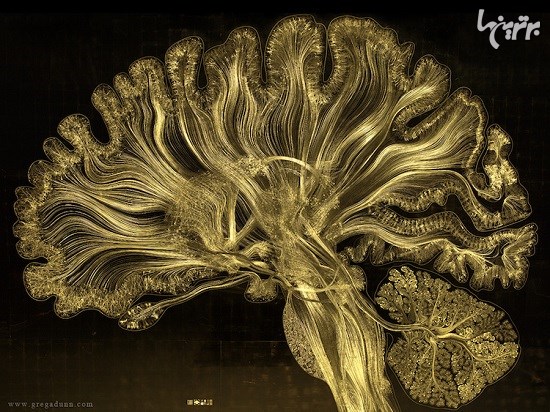 تصاویر جذاب و دیدنی از اسکن های مغزی پیشرفته