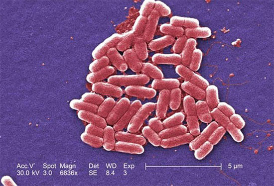 کشف باکتری مقاوم در برابر آنتی‌بیوتیک‌ها