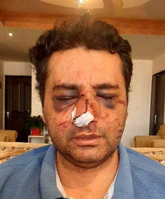 بازداشت عاملان ضرب و شتم پزشک پیرانشهری